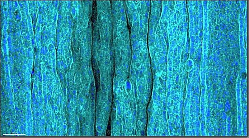The mystery of human wrinkles: what do the cells say?