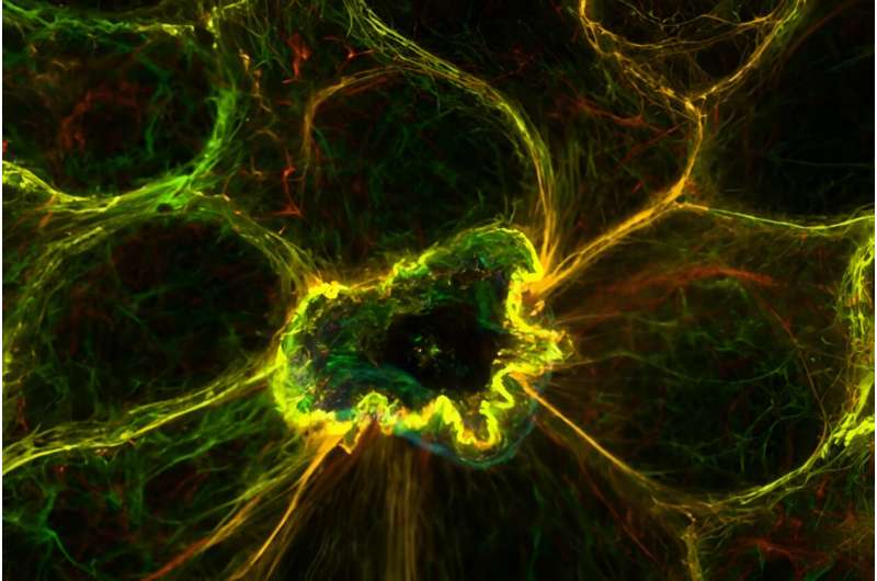 Keeping it together: How calcium signals help cells bury their dead neighbors