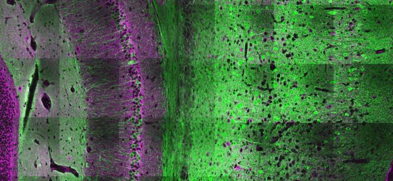 Brain molecule makes neurons less selective, deepening understanding of human cognition